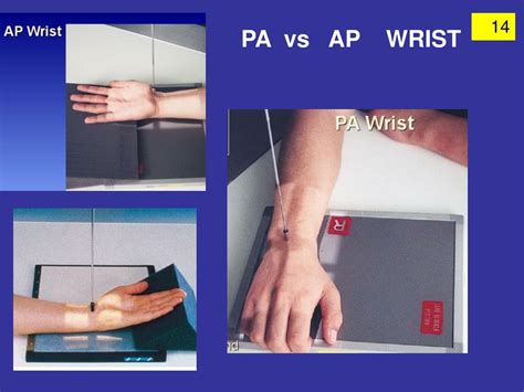 ap wrist|wrist ap position.